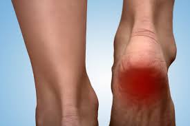 Causes and Treatments for Heel Pain