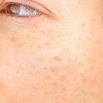 How Dermatology Addresses Aging Skin and Sun Damage