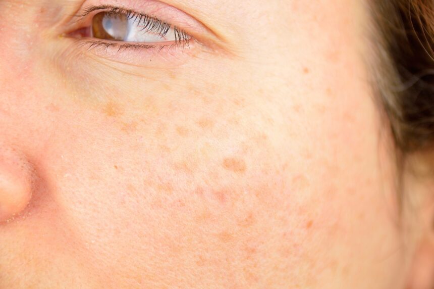 How Dermatology Addresses Aging Skin and Sun Damage