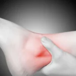 Recognizing the Signs of an Ankle Sprain and When to Seek Treatment