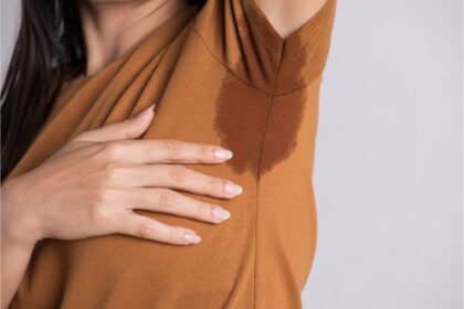 The Causes and Long-term Impact of Hyperhidrosis