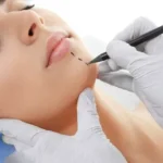 When To Get Plastic Surgery for Skin Issues