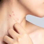 Why Regular Dermatology Consultations Are Beneficial for Skin Maintenance